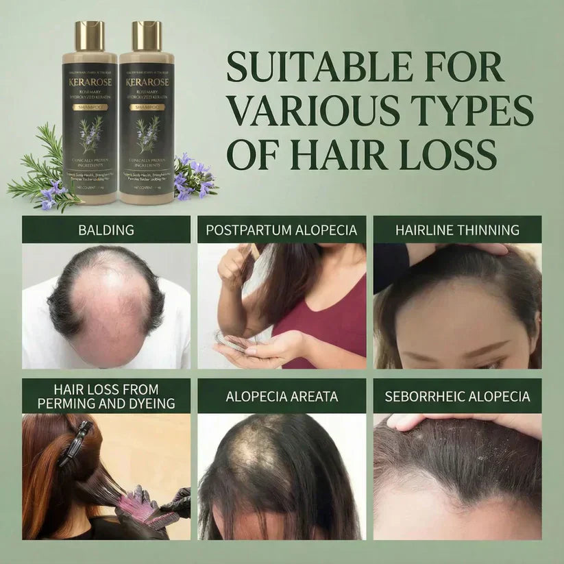 Kerarose Rosemary Shampoo For Hair Growth (Buy 1 Get 1 Free 🔥🔥)